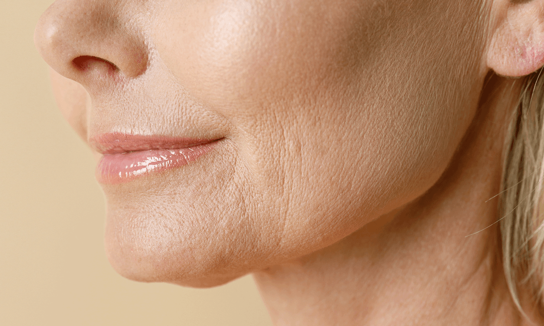 Fine Lines — Woodside Skin Clinic